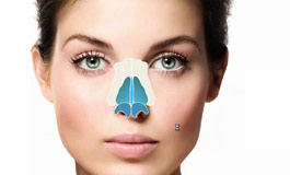 محدودیت سنی و انجام عمل بینی